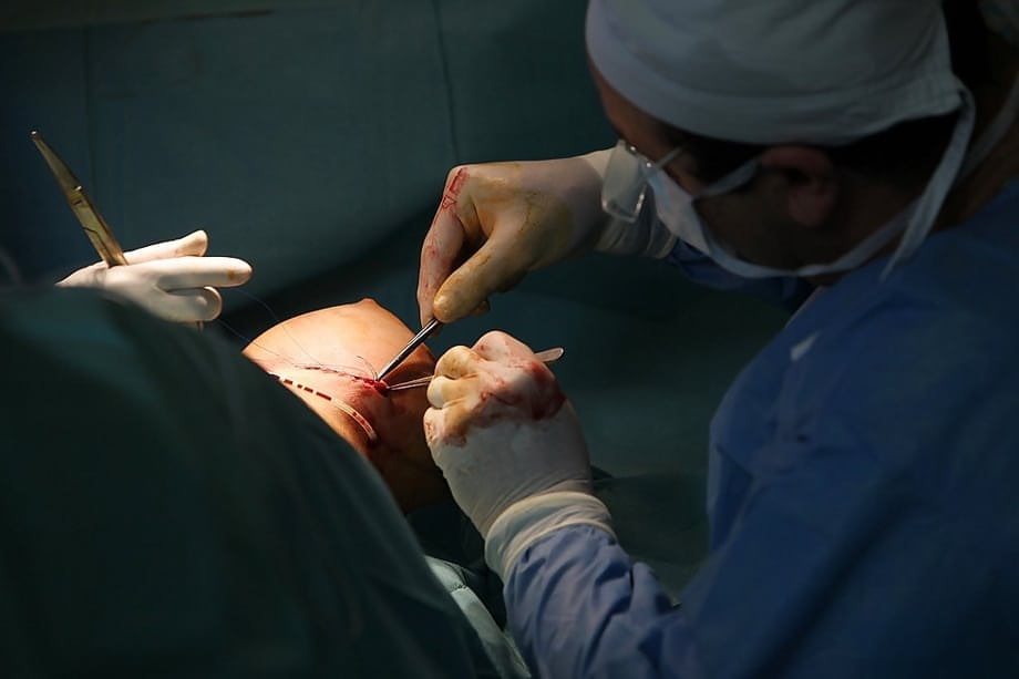 Aletta Ocean goes through successful plastic surgery operation