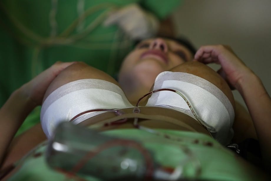 Aletta Ocean goes through successful plastic surgery operation