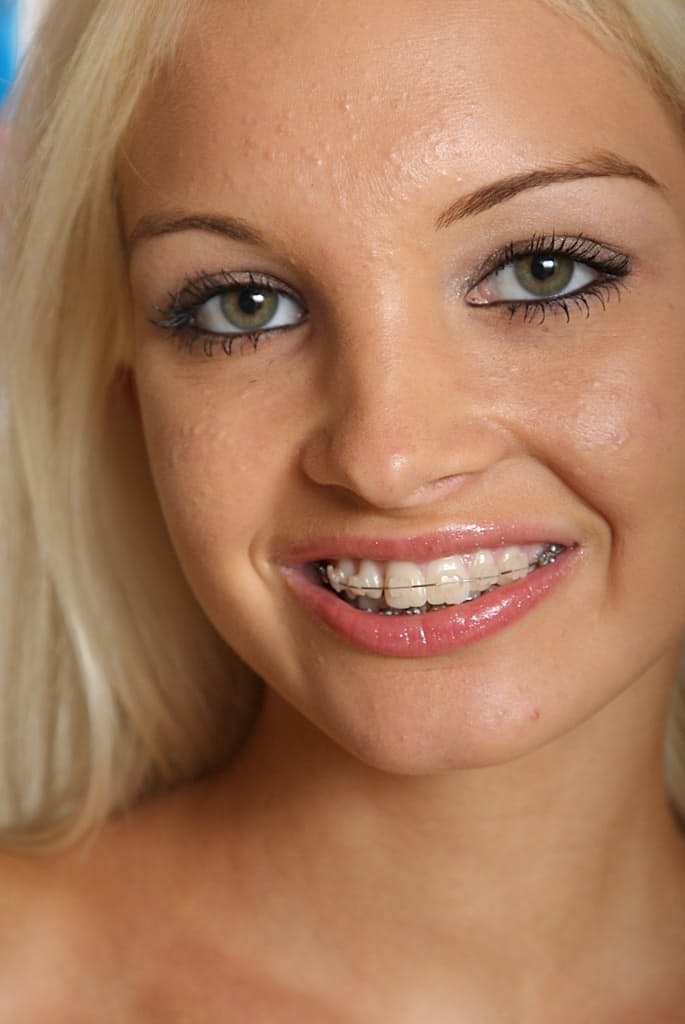 Barley legal hottie Franziska modelling solo in braces and panties