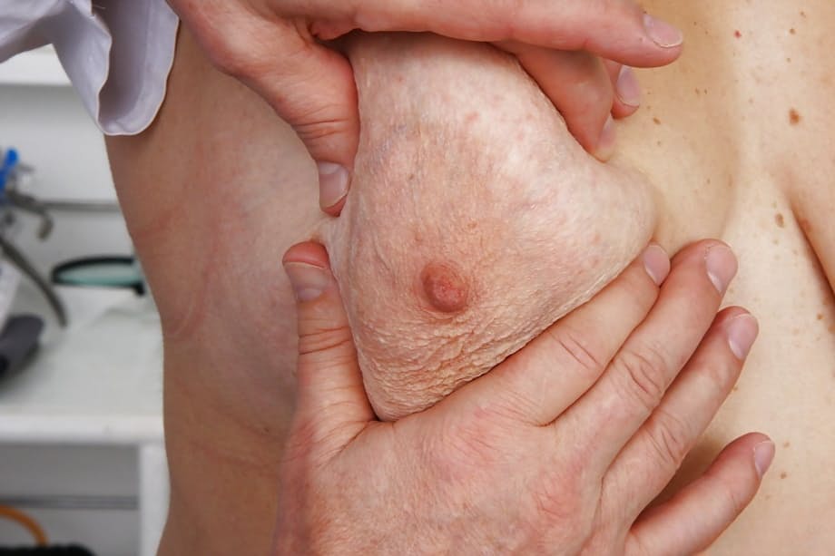 Mature fatty with hairy pussy receiving enema from gyno doctor